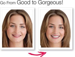 Snap-On Veneers – Instant Perfect Smile Teethñ