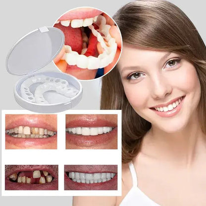 Snap-On Veneers – Instant Perfect Smile Teethñ