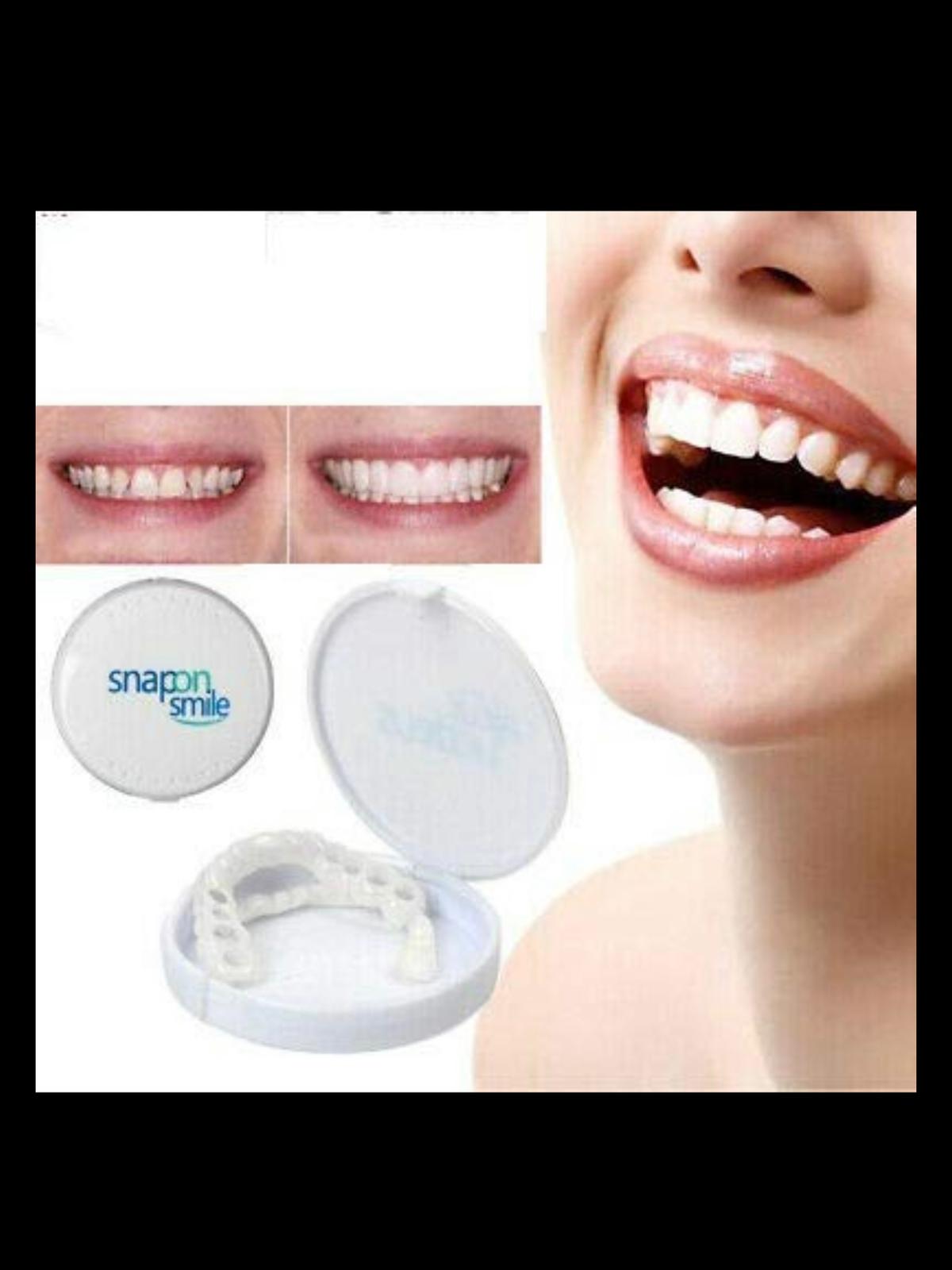 Snap-On Veneers – Instant Perfect Smile Teethñ