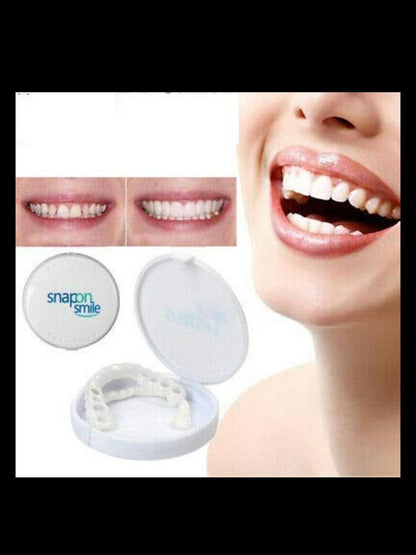 Snap-On Veneers – Instant Perfect Smile Teethñ